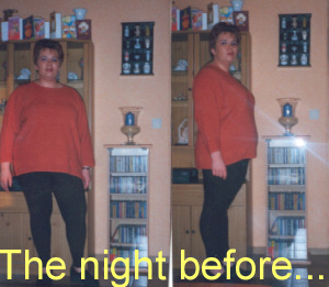 gastroplastie-the night before.jpg